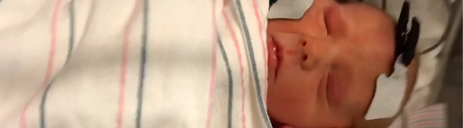 A baby undergoing a hearing test